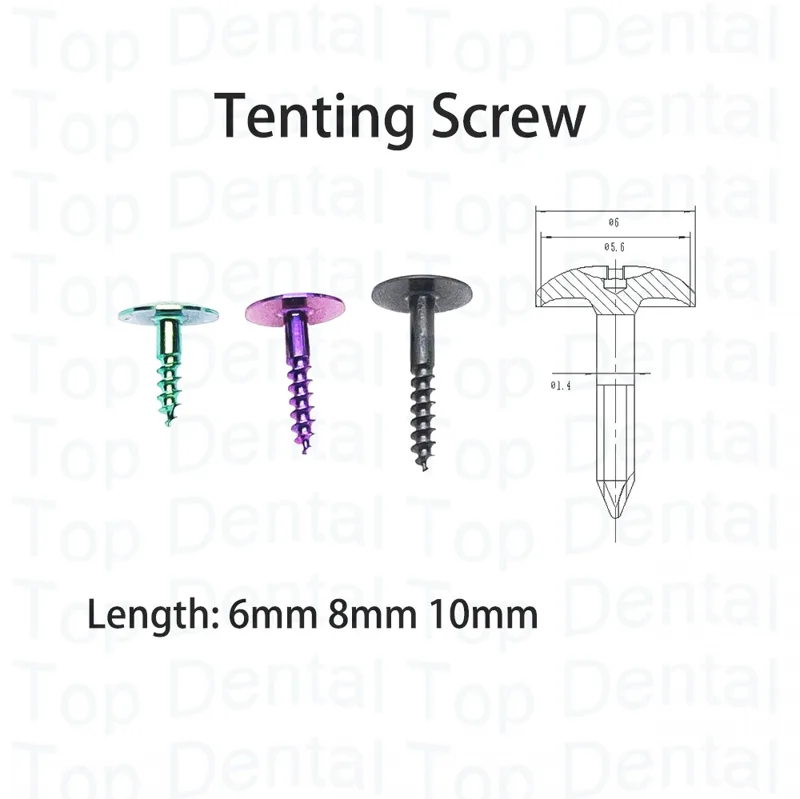 10 pçs sistema dental gbr para - Stabilizer Screw In avaliação e preço
